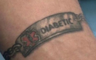 Is it okay to get a tattoo for medical reasons?