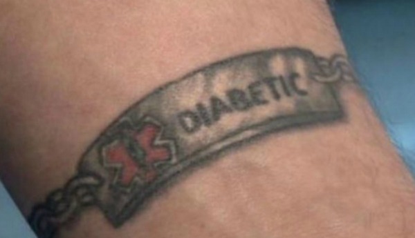 Is it okay to get a tattoo for medical reasons?