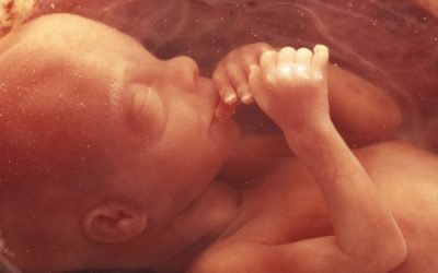 What about aborted babies? Is a fetal body enough?