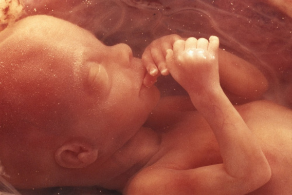 What about aborted babies? Is a fetal body enough?
